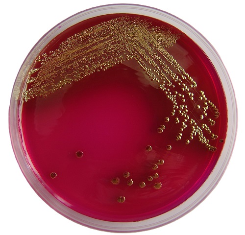 ecoliplate2